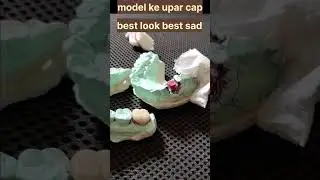 model cap fitting crown ceramic indoreddental#shade A2#your teeth can get hurt our touching no