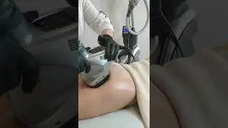 Velashape - коррекция фигуры в клинике Реформация