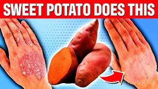 1 Sweet Potato Daily Before Bed Will Trigger These 8 Things To Your Body (Sweet Potato Benefits)