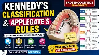 Kennedy's Classification & Applegate's Rules|Prosthodontics BDS|BDS Exam|Easy Explanation 