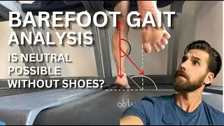 BAREFOOT GAIT ANALYSIS - Is a neutral gait possible without shoes? #barefootrunning #gaitanalysis