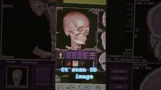 ct scan 3d face image facial bones in human body