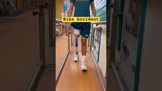🫵Above Knee Prosthetic Leg | Ottobock 3R80 Price | Ossur Proflex XC | #ossur #3r80 #artificiallimb