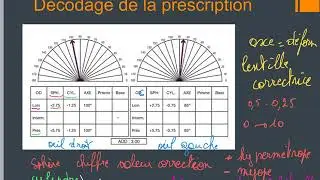 Prescription ophtalmique