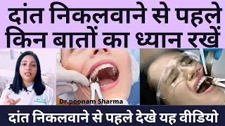 दांत निकलवाने से पहले किन बातो का ध्यान रखे ? Precautions Before And After  Tooth Extraction |