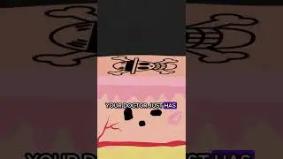 laser tattoo removal #fyp #education #animation #science #stem #college #medicine #shorts #funny #ed