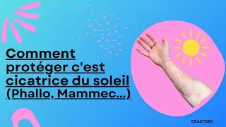 Comment prot&eacute;ger ses cicatrices du soleil (phallo, mammec..) // Ftm transgenre fran&ccedil;ais // CRAZYDEN