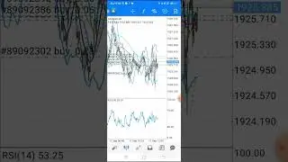 what is forex #forextrading #forexonline #forexlearning