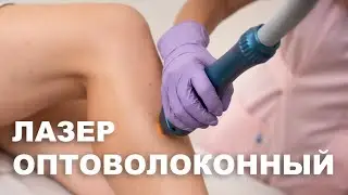 Оптоволоконный диодный лазер для удаления волос. Безболезненное и эффективное удаление волос