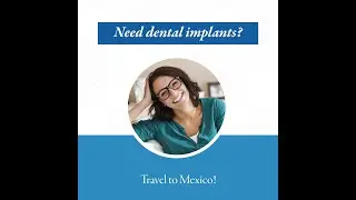 Save money on dental implants in Merida - Medical Tourism