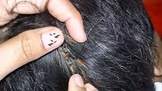 Lice Checking ASMR part6 #haircare #asmr #cleanhair #lice #kututv #piojos