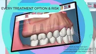 Consult-PRO: Software For Dentists | Post Op and Pre Op Videos | Informed Consent