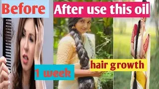  ಉದ್ದವಾದ ಕೂದಲ ಸೀಕ್ರೆಟ್| ವಾರಕ್ಕೆ ಒಮ್ಮೆ ಈ ಎಣ್ಣೆ ಹಚ್ಚಿ|Long hair growth|home remedies of long hair 
