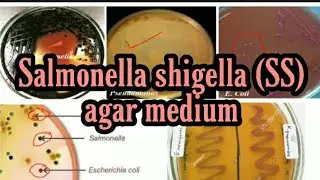 sallmonela shigella (SS) agar: culture media lecture 15