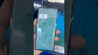 Honor X9a Screen Lock & FRP ( Google ) Lock Remove Done.