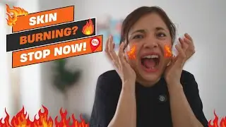Skin Burns After Skincare? Here&rsquo;s Why! 🔥