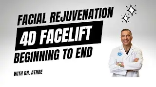 4D facelift: Analysis, Game plan, results and a patient testimonial of Full face facial rejuvenation