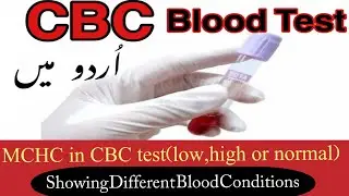 MCHC in CBC Explained | Low, Normal & High Values in Urdu/Hindi