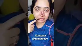 Zomato hitesha Incident / Zomato Delivery Boy Punches Girls