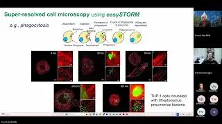 OpenScopes: an open, modular platform to widen access in advanced microscopy