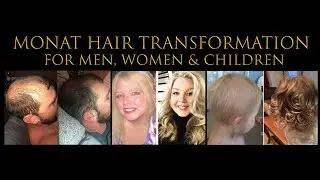 Monat Results Before After, Nontoxic Healthy, Grow Hair Fast. Fix Hair Loss, Alopecia, Postpartum