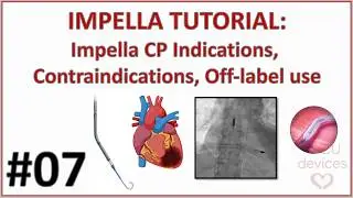 IMPELLA CP INDICATIONS, CONTRAINDICATIONS & OFF-LABEL USE - ECPELLA / ECMELLA (IMPELLA GUIDE 007)