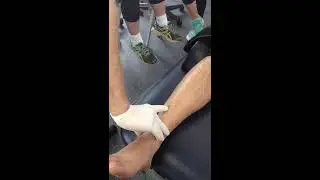Extensor Hallucis Longus Dry Needling