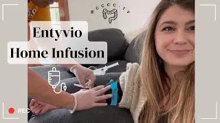 Home Infusion of Entyvio for Ulcerative Colitis
