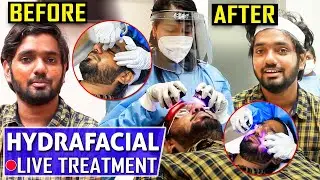 Live Demo: Acne, Pimple-யில் இருந்து உங்கள் முகம் 45mins-ல் பிரகாசிக்க Easy வழி! -Dr. Monisha பேட்டி