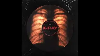 БИЛИК, Markul - X-Ray [Remix. Cuteboy] Slowed+Reverb
