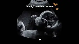 Bijzondere momentjes tijdens een pretecho❤️