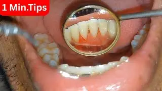 दांत सफेद करने का तरीका | Dant Safed Kaise Kare | Teeth Care #teethcleaning #teethwhitening