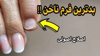 بدترین فرم ناخن؟ | اصلاح اصولی که همه بلد نیستن