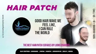 Hair patch, clipping, tapping, bonding, fixing, hair replacement, Call 9889991666
