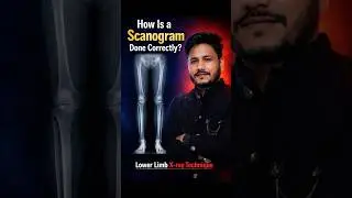 How Is a Lower Limb Scanogram Done Correctly? #shorts