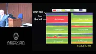 Understanding GERD