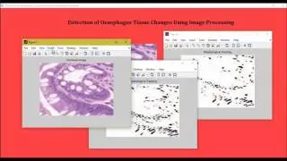 Detection of Oesophagus Tissue Changes Using Image Processing matlab projects