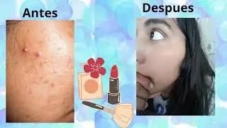 Mascarilla para quitar las espinillas y acne!! 👆🫶🫢