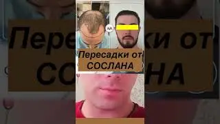 Как работают клиники по пересадке волос. Что выберете &ndash; конвейер или индивидуальный подход?