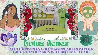 Lotus professional acnex facial kit|| How To Use ||