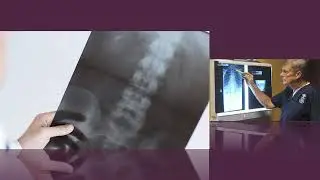 Digital Radiographic Mensuration Analysis | Mcdonough, GA - The Paulk Clinic
