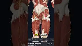 HOW TO FIX YOUR SCIATICA!#youtubeshorts #pain #trending