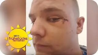 Von TAXIFAHRER KRANKENHAUSREIF GESCHLAGEN – Taxifahrt aus der Hölle | SAT.1 Frühstücksfernsehen | TV