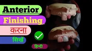 Ceramic Finishing|| Anterior Finishing| Laboratory| Ceramic| Anatomy| Metal Ceramic| Lab| Porcelain|