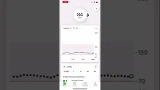 Dexcom G7 Calibration