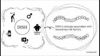 Medical Mystery  Bone Disease DISH
