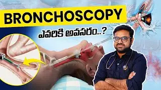 What is bronchoscopy test telugu | బ్రోంకోస్కోపీ ఎందుకు చేస్తారు? | Lung infections | Dr Kiran Kumar