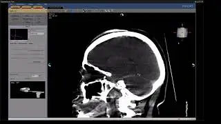 Case-2, ICA ICAD, 13-01-2026