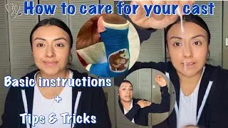 How to care for you cast/ Basic instructions + tips and tricks!