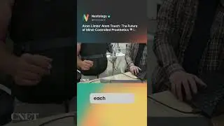 Atom Touch: The Revolutionary Mind-Controlled Prosthetic with Sense of Touch!